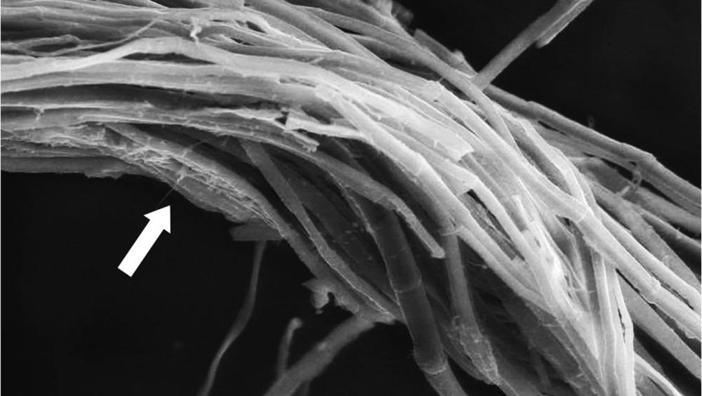 Scanning electron microgrpah of carbonised linen fibres